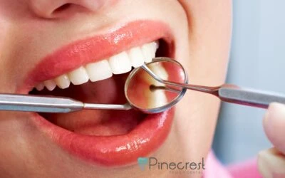 Cosmetic Dental Bonding in Pinecrest FL